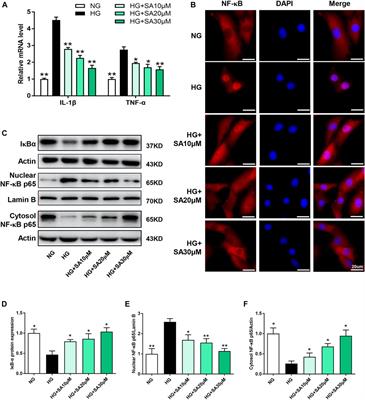 Sappanone a prevents diabetic kidney disease by inhibiting kidney inflammation and fibrosis via the NF-κB signaling pathway